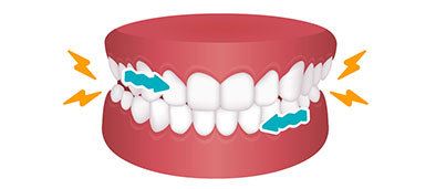 grinding teeth